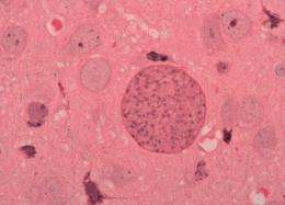 'Promiscuous parasites' hijack host immune cells