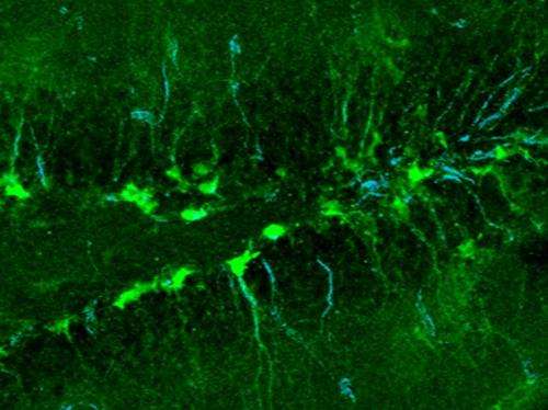 脂质代谢调节成体神经干细胞的活性