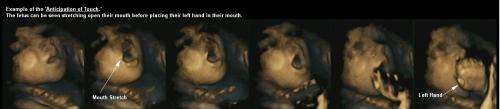 Babies learn to anticipate touch in the womb