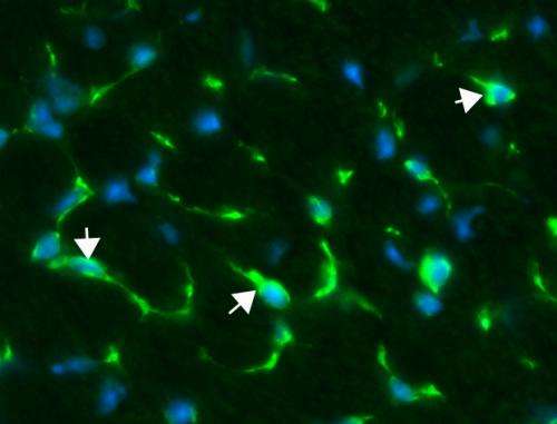 Stem-cell approach shows promise for Duchenne muscular dystrophy