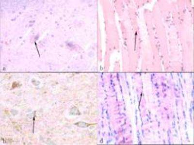 Basic fibroblast growth factor protects injured spinal cord motor endplates