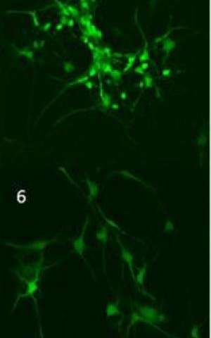S14G-humanin is a new hope for Alzheimer's disease