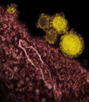 黎巴嫩记录MERS病毒的第一个病例