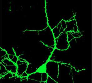 帕拉迪斯实验室发现了神经分支的根源