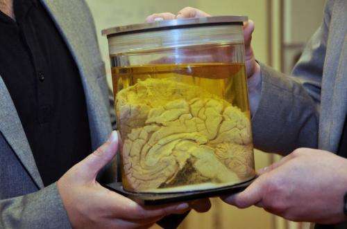 科学家发现大脑的反牵引系统