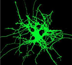帕拉迪斯实验室发现了神经分支的根源