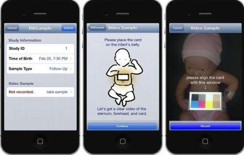New smartphone app can detect newborn jaundice in minutes