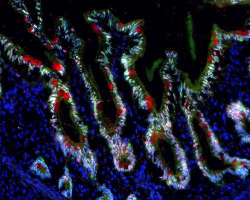 Lab-developed intestinal organoids form mature human tissue in mice