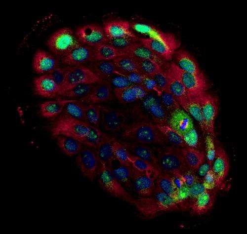 Funding for better understanding of cancer-causing cell defect