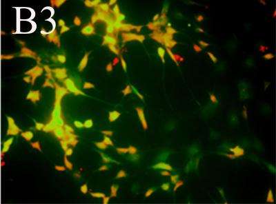 GDNF transfection promotes neuronal differentiation of bone marrow mesenchymal stem cells