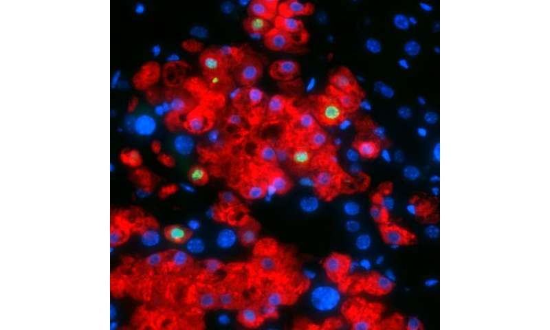 科学家们将皮肤细胞转化为有功能的肝细胞