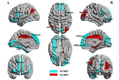 Resting-state functional connectivity as an auxillary diagnosis of depression