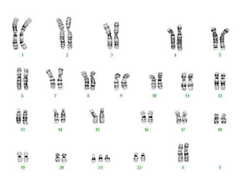 Trisomy 21: How an extra little chromosome throws the entire genome off balance