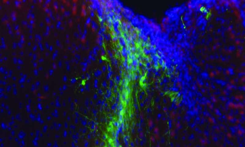 'Hydrogels' boost ability of stem cells to restore eyesight and heal brains