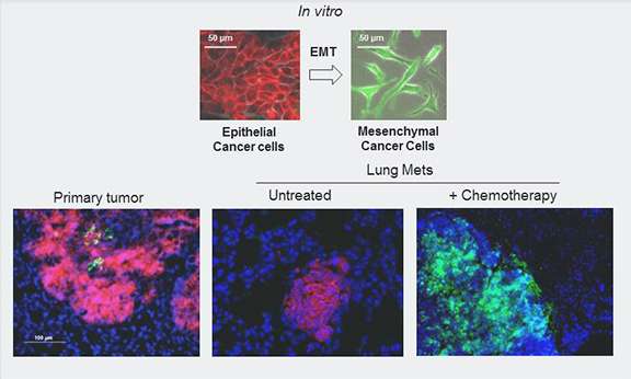 Study of breast cancer metastasis upends conventional wisdom, suggesting new treatment strategy