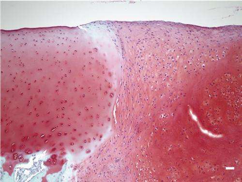 Scaffold-free iPS cell-based hyaline cartilage for joint repair