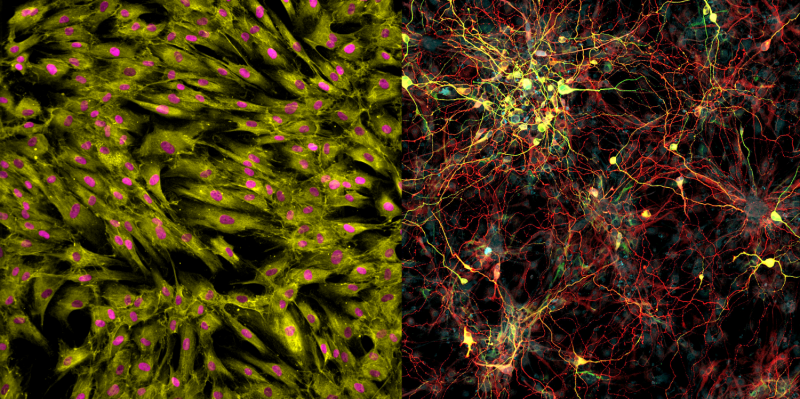 Aged neurons can now be generated using stem cell technology