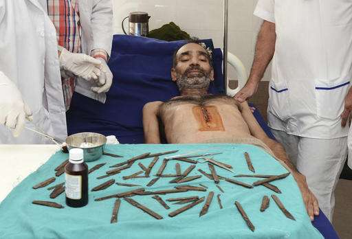 印度的医生从男人的胃中删除了40刀具（更新）