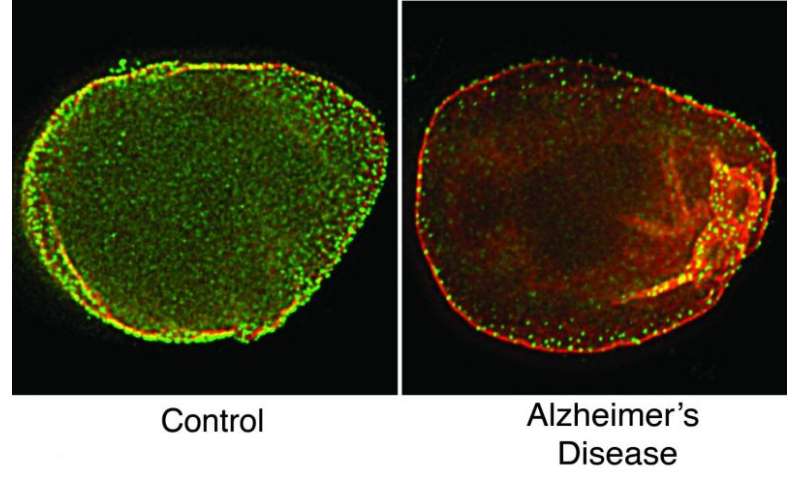 阿尔茨海默病影响细胞中网状支架紊乱