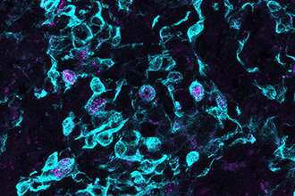 免疫T细胞开发中揭示了新的质量控制