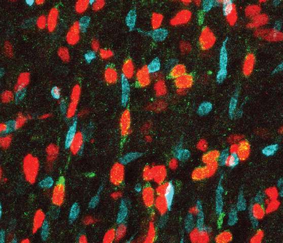 Why neural stem cells may be vulnerable to Zika infection