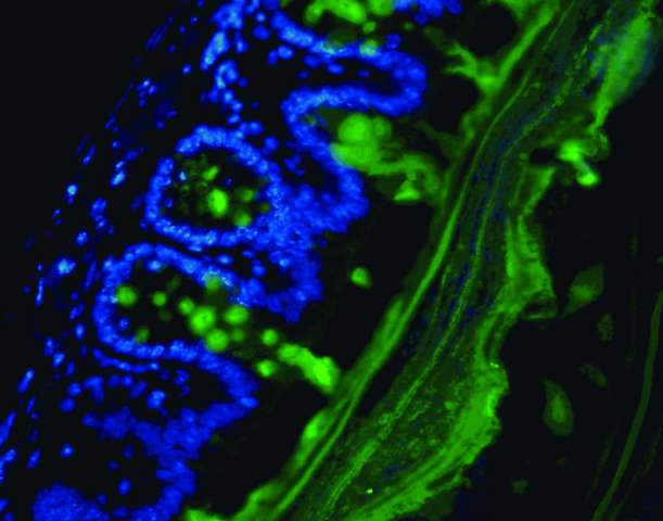 High-fiber diet keeps gut microbes from eating colon's lining, protects against infection