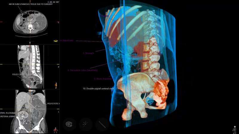 New tool for medical students’ anatomy lessons – a virtual scalpel