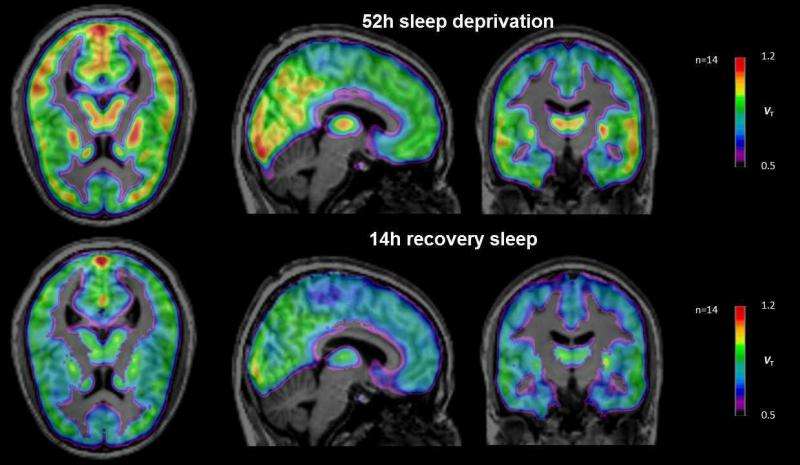 How the brain reacts to sleep deprivation