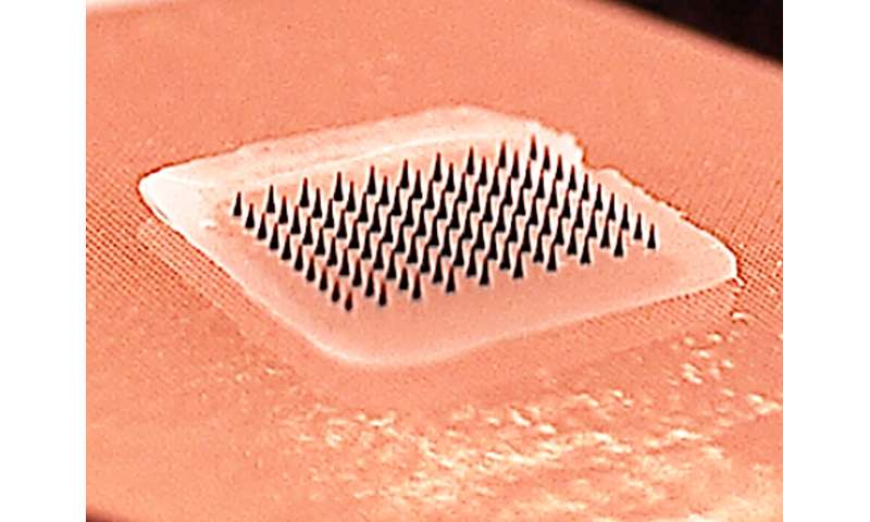 Microneedle Patches For Flu Vaccination Prove Successful In First Human