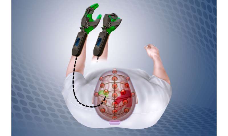 思维控制的设备有助于中风患者重新培训大脑移动瘫痪的手