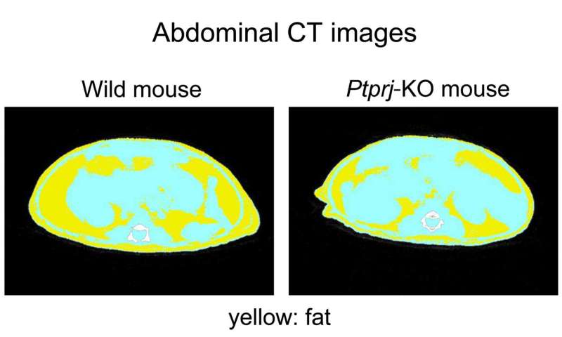 Obese inducing brain mechanism