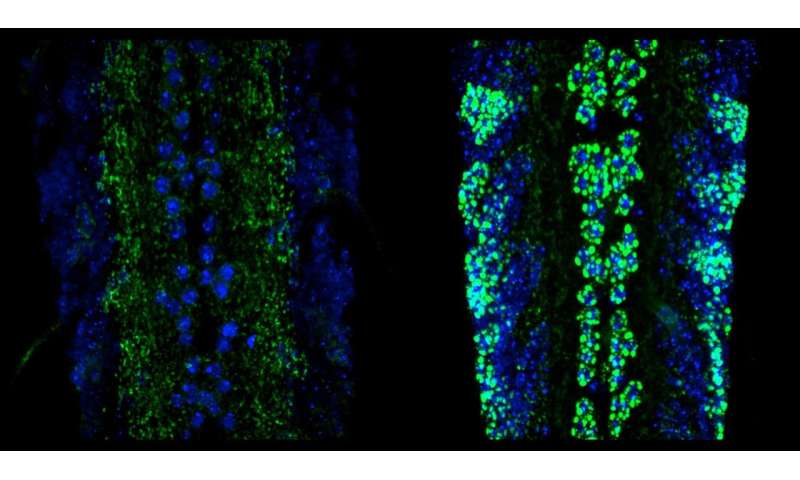 Pathway in neurons may contribute to neurodegenerative disease