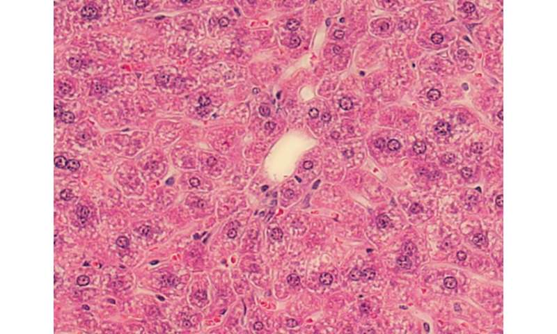 救世主的t细胞可能是肝脏免疫细胞的敌人