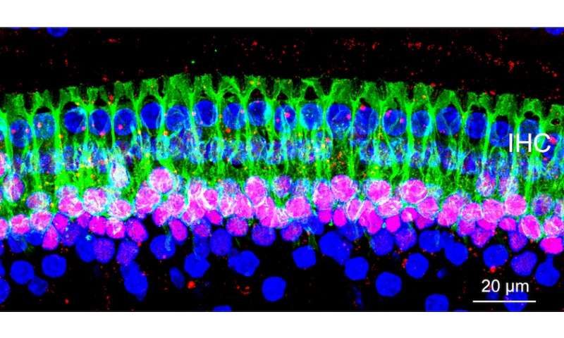 Second cause of hidden hearing loss identified
