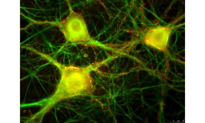 Stem cells derived neuronal networks grown on a chip as an alternative to animal testing