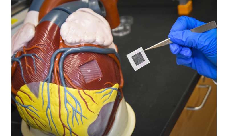 Researchers build a patch to help cardiac muscle beat more strongly after a heart attack