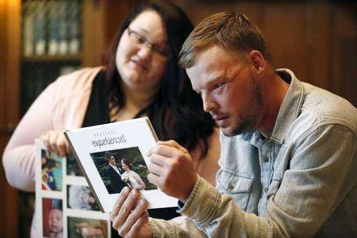 Tearful meeting for pair forever linked by face transplant