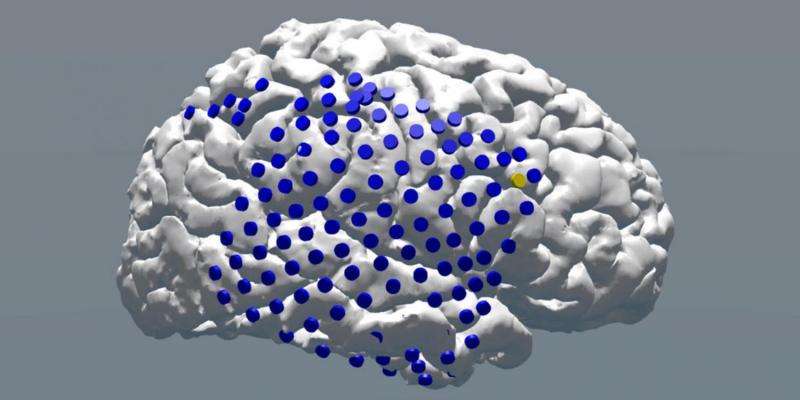 电气刺激你的大脑可以提高内存 - 但这是它并不总是有效的一个原因
