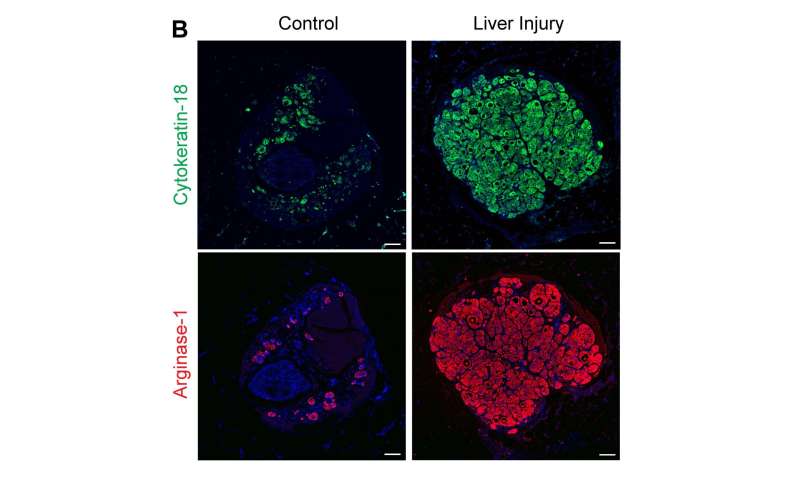 Engineered liver tissue expands after transplant