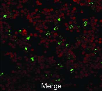 Scientists reverse diabetes in a mouse model using modified blood stem cells