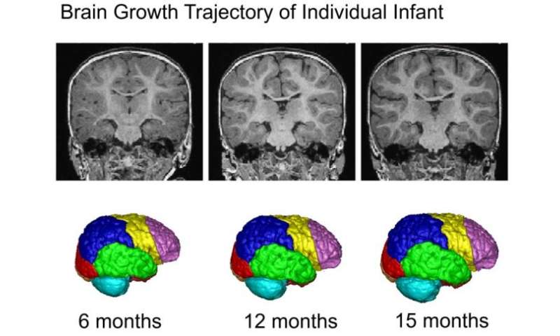 New imaging techniques track cocaine’s effect on infant brains