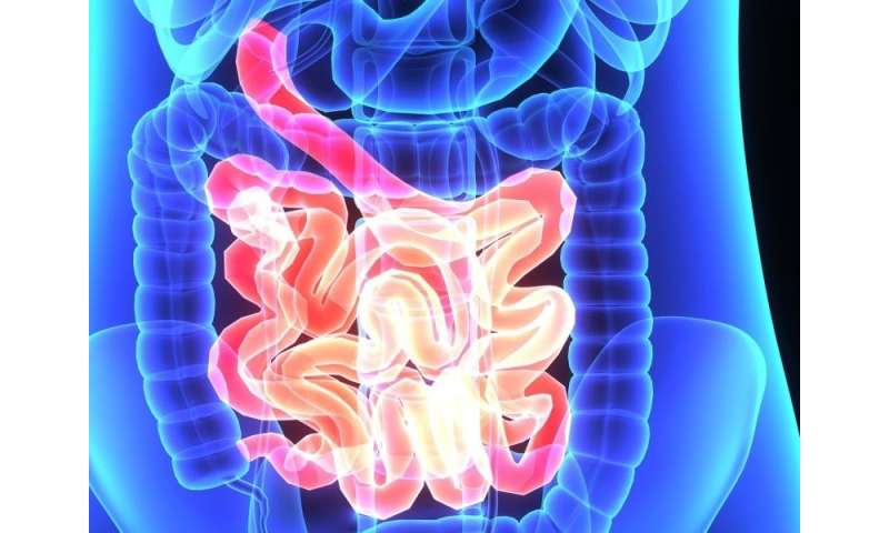 Normalized Post Op Cea May Help Predict Colon Cancer Prognosis