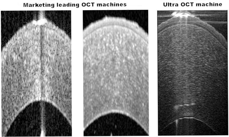 Sight-saving imaging technology secures funding