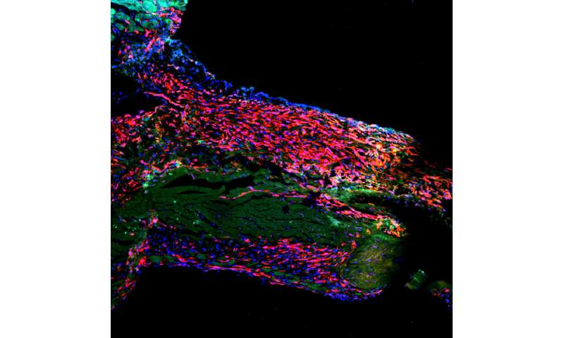 A sobering conclusion: Adult hearts contain no stem cells