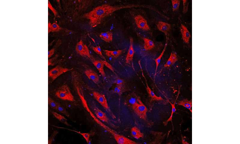 Blocking matrix-forming protein might prevent heart failure