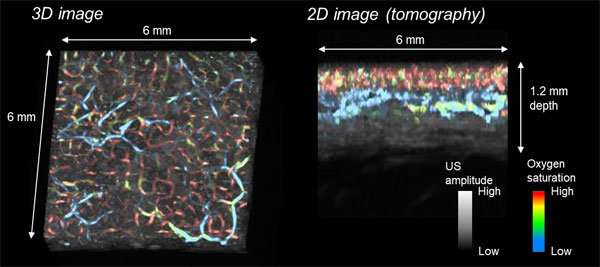 In vivo skin imaging technology developed