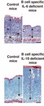Regulatory and effector B cells control scleroderma