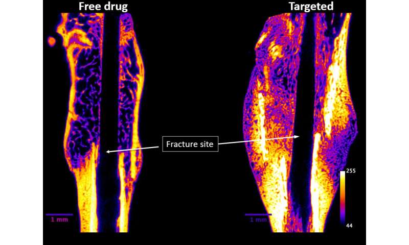 $1.7 million SBIR grant fast-tracks bone fracture healing