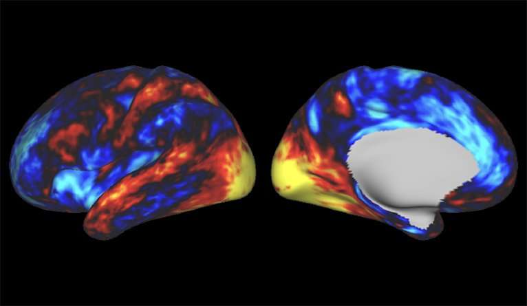 Researchers explain how LSD changes perception