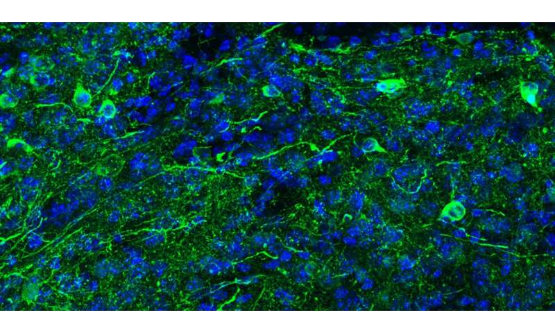 科学家们意外地将成熟的小鼠GABA神经元重新编程成多巴胺能样神经元